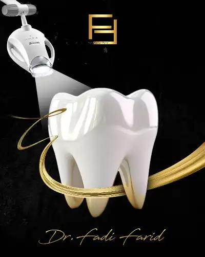 تبييض الاسنان